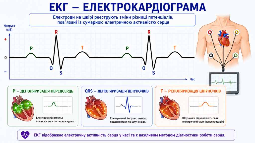 ЕКГ серця